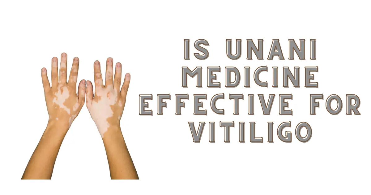 Is Unani Medicine Effective For Vitiligo